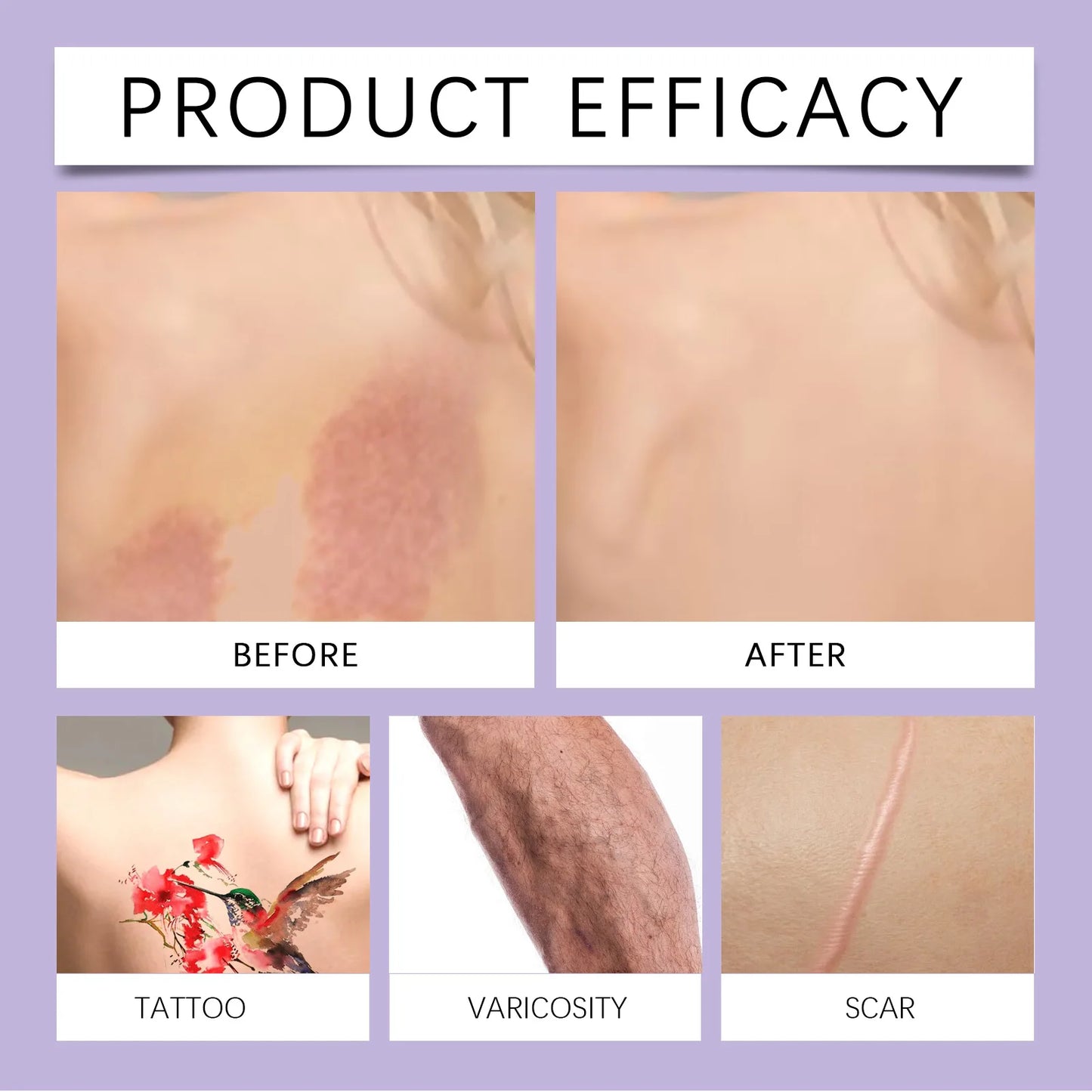 EELHOE 74mL Body Coverage Perfector, Even Skin Tone, Covering Tattoos, Universal For Face And Body, No Burden Makeup Effect