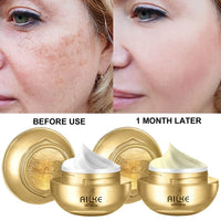 AILKE Whitening Dark Spots Remove Facial Skin Care Cream With Collagen, Reduce Freckles, Wrinkles, Women Premium Face Product